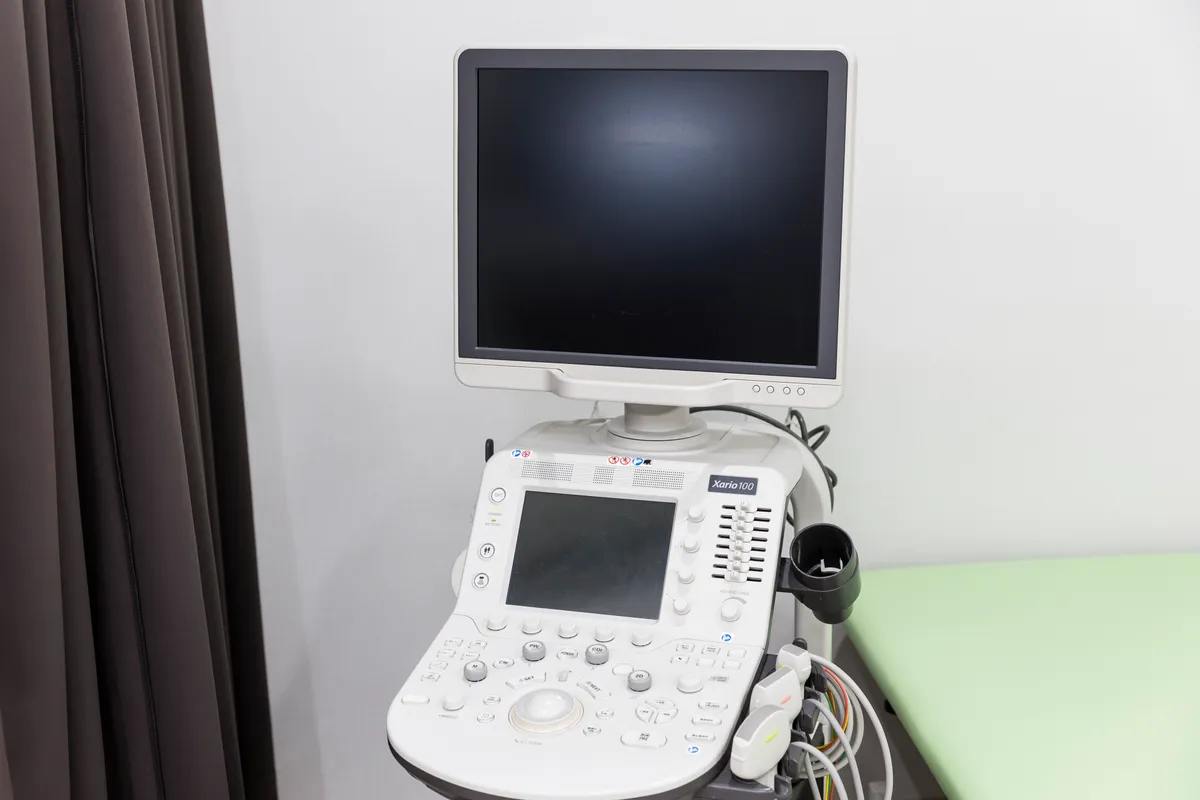 超音波（エコー）診断装置 東芝Xario100